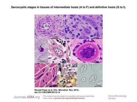 Sarcocystis Stages In Tissues Of Intermediate Hosts A To F And Definitive Hosts G To I