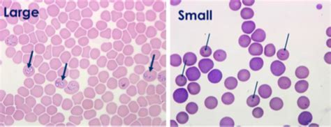 Piroplasm Babesia Flashcards Quizlet