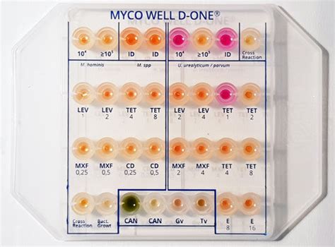 鉴定分析快速诊断套装 Ms01283 Cpm Sas 抗菌敏感性 支原体 阴道加特纳菌