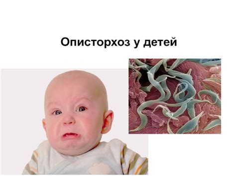 Описторхоз у детей презентация, доклад