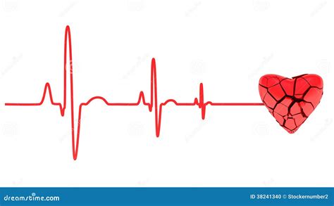 Cardiac arrest, ECG stock illustration. Illustration of line - 38241340