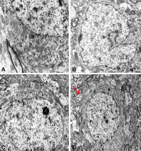 Transmission Electron Microscope TEM Analysis Of The Brain Cortex