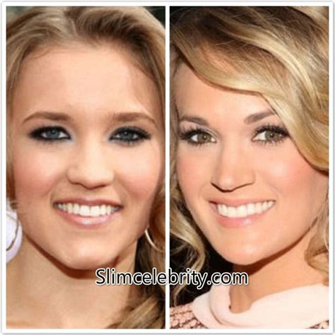 Carrie Underwood Plastic Surgery Before and After find photos here ...