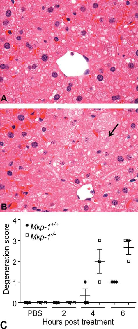 Enhanced Centrilobular Congestion Hepatocellular Degeneration Download Scientific Diagram