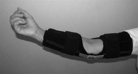 Osteochondritis Dissecans Of The Elbow Physiopedia