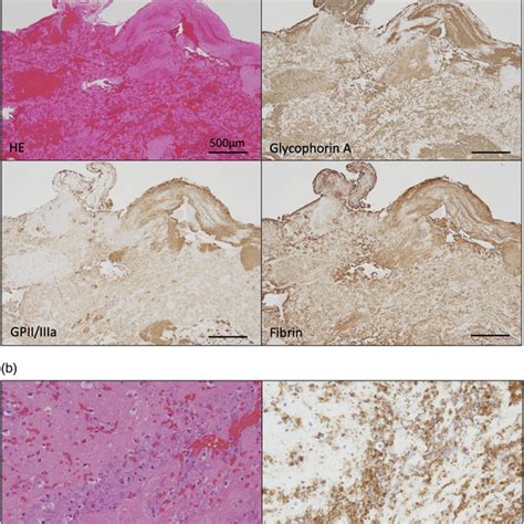 Representative Histological And Immunohistochemical Microphotographs Of