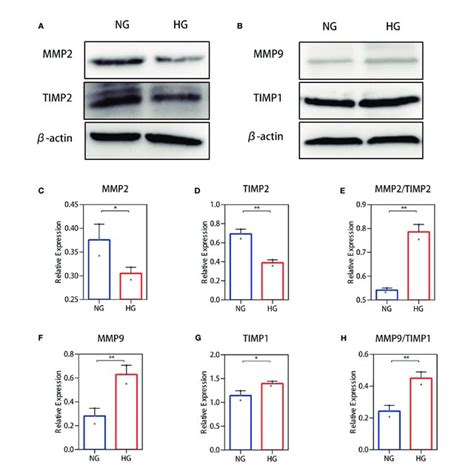 Western Blot Analysis Of The MMP 2 TIMP 2 And MMP 9 TIMP 1 Ratio In