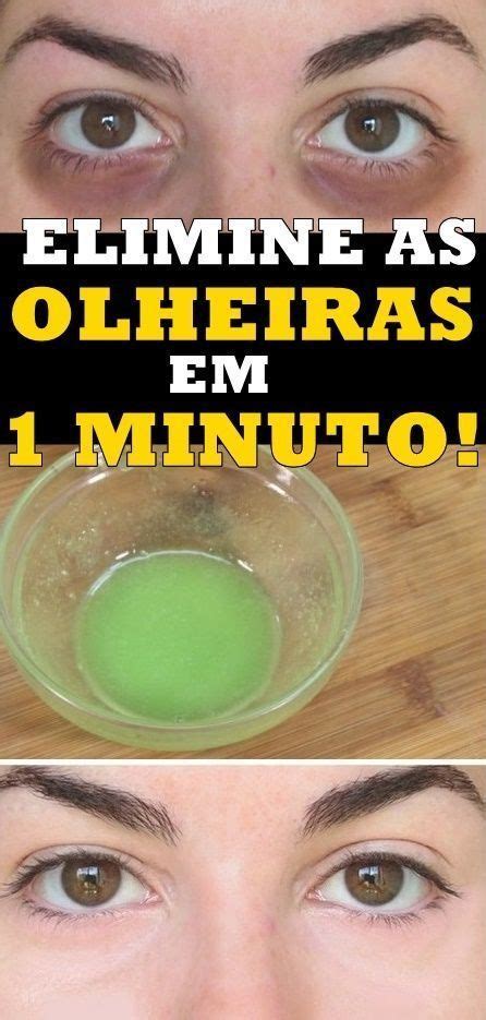 Como Acabar As Olheiras Em 1 Minuto Passo A Passo Olheiras