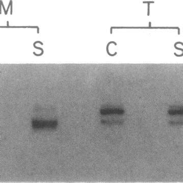 Nondenaturing Electrophoresis Of Monomeric M And Trimeric T Forms