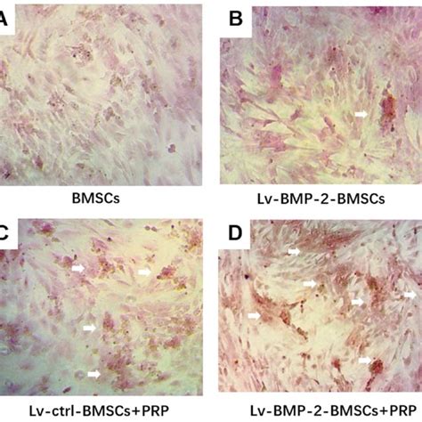 Osteogenic Differentiation In Bmscs Cells Were Cultured With