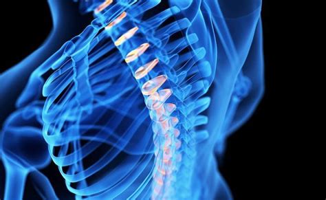 What Is Spinal Fusion And How Can You Benefit Orthopaedic Institute