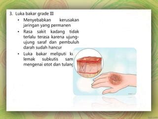 pertolongan_pertama_pada_luka_bakar.pptx