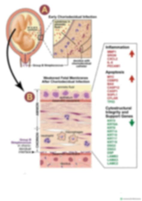 Solution Streptococcus Agalactiae Notes Studypool