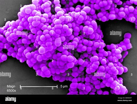 Scanning Electron Micrograph Sem Of Clusters Of Gram Positive Beta