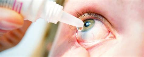 Epidemic Keratoconjunctivitis Treatment Market is exhibiting a CAGR of 5% from 2023 to 2033 ...