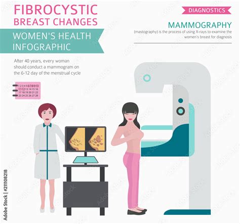 Fibrocystic Breast Changes Disease Medical Infographic Diagnostics