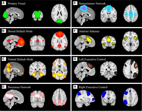 Frontiers Large Scale Brain Functional Network Integration For