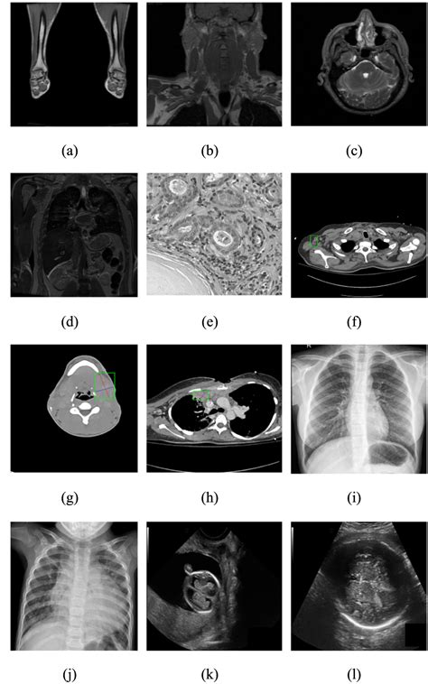 Improved Structural Sparse Representation And Quantization Constraint