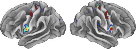 Renowned ‘Homunculus’ Revisited