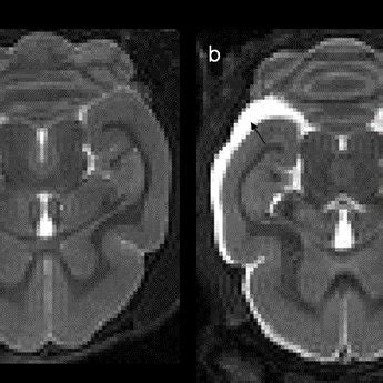 | Aged related atrophy in the mouse lemur brain. Anatomical MRI images... | Download Scientific ...