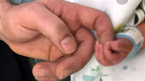 Covid all ospedale Bambino Gesù raddoppiati i ricoveri 50 piccoli in