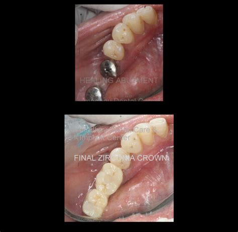 Gallery – Madhav Dental Clinic