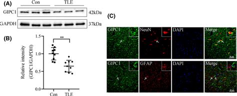 Expression And Location Of Gaip Interacting Protein C Terminus