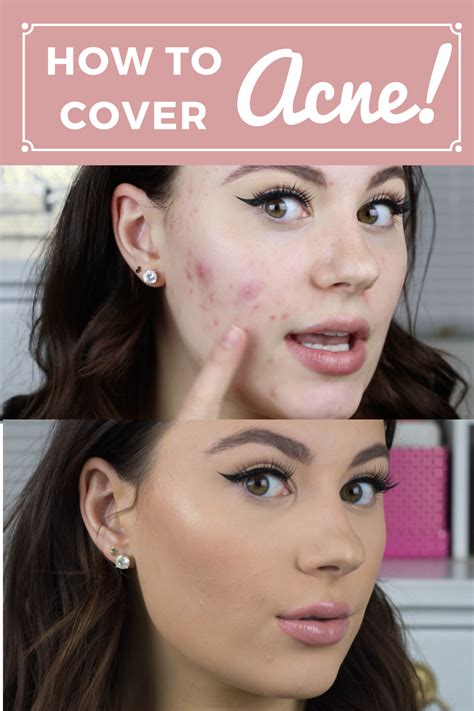 How To Cover Up A Scab With Makeup