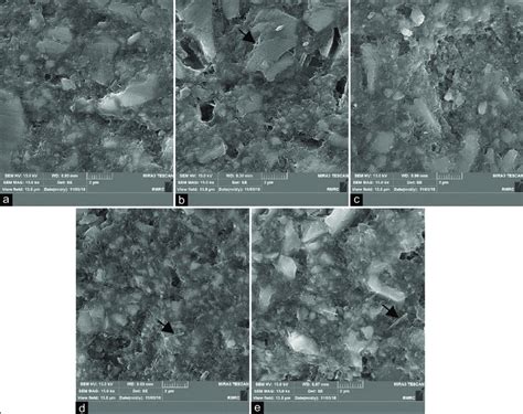 Scanning electron microscopy images of composites discs (×15K). (a ... 
