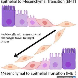 Epithelial To Mesenchymal Transition EMT And Mesenchymal To