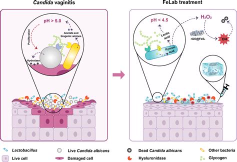 A Probiotic Nanozyme Hydrogel Regulates Vaginal Microenvironment For