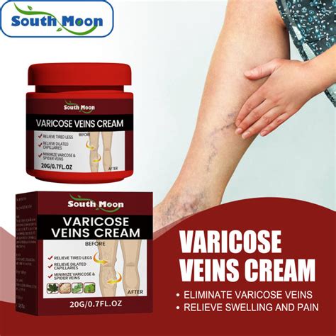 5 7 Days Fast Delivered South Moon 20g Varicose Veins Cream For