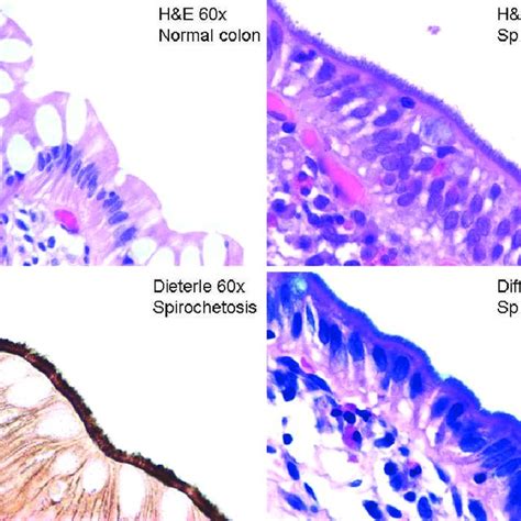 Hematoxylin And Eosin Hande Stain Of Normal Colonic Mucosa Hande Download Scientific Diagram