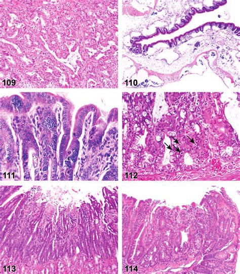 Degeneration Necrosis Brunner S Glands FigUre 110 Mouse Ileum