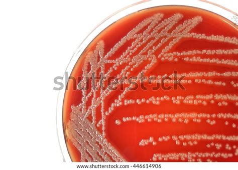 Colonies Red Bacteria Shown Gamma Hemolysis Stock Photo (Edit Now ...