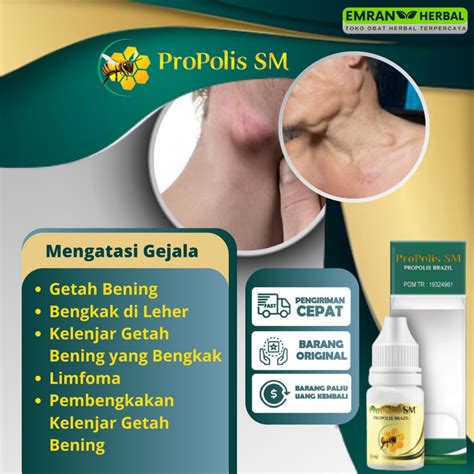 Jual Obat Kelenjar Getah Bening Obat Bengkak Di Leher Obat Benjolan