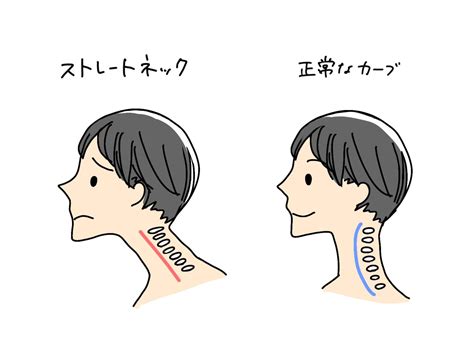 上を向くと首が痛いときの治し方は？原因に合わせた対処法を解説