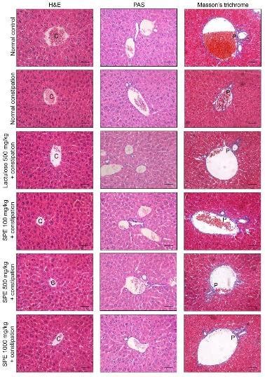 Effect Of Sargassum Plagiophyllum Extract SPE Pretreatment On The