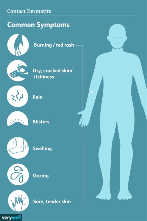 Contact Dermatitis: Signs, Symptoms, and Complications