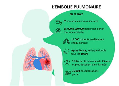 Embolie Pulmonaire Cause Sympt Mes Traitement