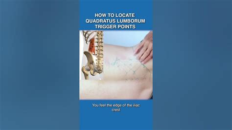 How To Locate Quadratus Lumborum Trigger Points Youtube