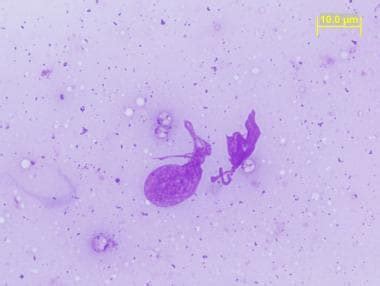 Leishmania Under Microscope