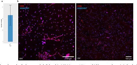 Universal Method For The Isolation Of Microvessels From Frozen Brain