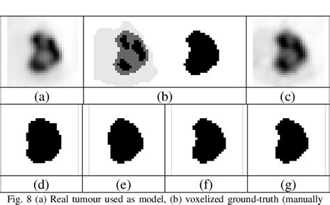 Figure 1 From A Fuzzy Locally Adaptive Bayesian Segmentation Approach