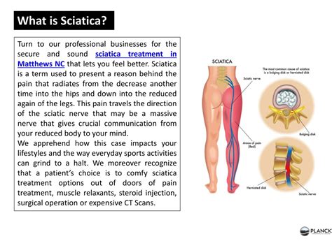 Ppt Get Effective Sciatica Treatment In Matthews Nc Powerpoint