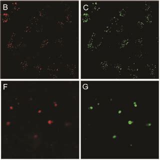 Confocal Fluorescence Images Of HeLa Cells And Living Liver Tissue