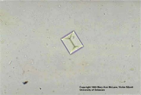 triple phosphate crystal in urine | Medical Laboratories