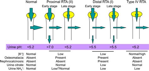 Pathophysiology of Renal Tubular Acidosis: Core Curriculum 2016 - American Journal of Kidney ...