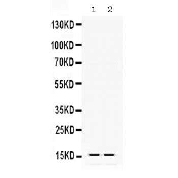 Anti TTR Transthyretin Antibody Rabbit Anti Rat Polyclonal LSBio