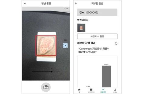 라이프시맨틱스 피부암 진단보조 Sw 확증 임상시험 계획 승인 네이트 뉴스